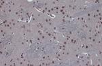 FOXO3A Antibody in Immunohistochemistry (Paraffin) (IHC (P))