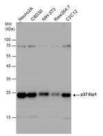 p27 Kip1 Antibody in Western Blot (WB)