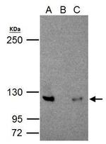 NFkB p100 Antibody in Immunoprecipitation (IP)