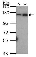 NFkB p100 Antibody in Western Blot (WB)