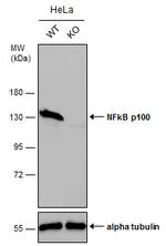 NFkB p100 Antibody