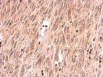 SOS2 Antibody in Immunohistochemistry (Paraffin) (IHC (P))