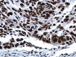 Histone H2A.X Antibody in Immunohistochemistry (Paraffin) (IHC (P))