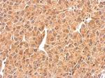 RAB5 Antibody in Immunohistochemistry (Paraffin) (IHC (P))