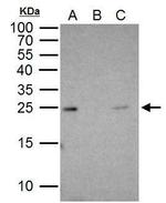 RAB5 Antibody in Immunoprecipitation (IP)