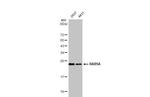 RAB5 Antibody in Western Blot (WB)