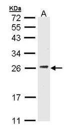 CD3g Antibody in Western Blot (WB)