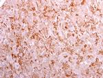 CD3g Antibody in Immunohistochemistry (Paraffin) (IHC (P))