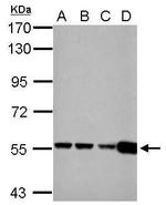 GluD1/GluD2 Antibody in Western Blot (WB)