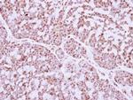 IRF9 Antibody in Immunohistochemistry (Paraffin) (IHC (P))