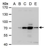 Dengue Virus Type 2 NS3 Antibody in Western Blot (WB)