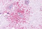 CCR3 Antibody in Immunohistochemistry (Paraffin) (IHC (P))