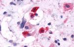 CRTH2 Antibody in Immunohistochemistry (Paraffin) (IHC (P))