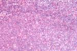 CRTH2 Antibody in Immunohistochemistry (Paraffin) (IHC (P))