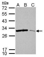 14-3-3 sigma Antibody in Western Blot (WB)