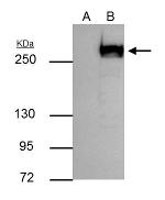 mTOR Antibody in Immunoprecipitation (IP)