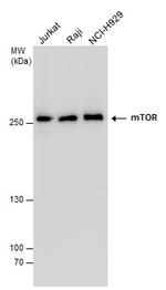 mTOR Antibody in Western Blot (WB)