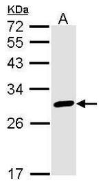 Calretinin Antibody in Western Blot (WB)