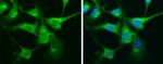 Calretinin Antibody in Immunocytochemistry (ICC/IF)