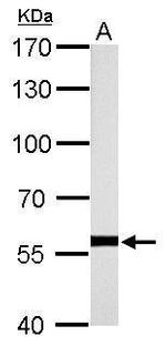 HSP60 Antibody in Western Blot (WB)