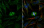 gamma Tubulin Antibody in Immunocytochemistry (ICC/IF)