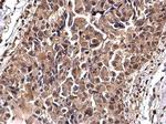 gamma Tubulin Antibody in Immunohistochemistry (Paraffin) (IHC (P))