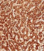 ATG7 Antibody in Immunohistochemistry (Paraffin) (IHC (P))