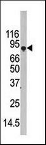 ATG7 Antibody in Western Blot (WB)