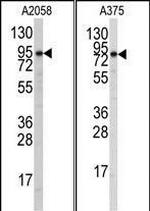 ATG9A Antibody in Western Blot (WB)