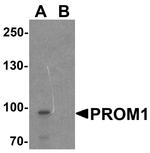 CD133 Antibody in Western Blot (WB)