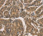 ICAT Antibody in Immunohistochemistry (Paraffin) (IHC (P))