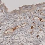 VISTA Antibody in Immunohistochemistry (IHC)