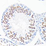 Cathelicidin Antibody in Immunohistochemistry (Paraffin) (IHC (P))