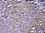 NOV Antibody in Immunohistochemistry (Paraffin) (IHC (P))