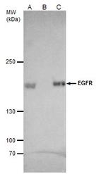 EGFR Antibody in Immunoprecipitation (IP)