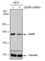 EGFR Antibody in Western Blot (WB)