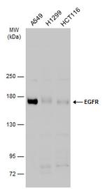 EGFR Antibody in Western Blot (WB)