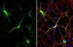 MAP2 Antibody in Immunocytochemistry (ICC/IF)