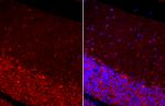 MAP2 Antibody in Immunohistochemistry (Paraffin) (IHC (P))