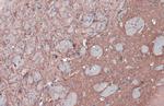 MAP2 Antibody in Immunohistochemistry (Paraffin) (IHC (P))