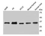 CDK2 Antibody in Western Blot (WB)