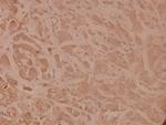 TNFR1 Antibody in Immunohistochemistry (Paraffin) (IHC (P))