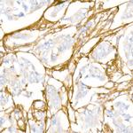 COL1A1 Antibody in Immunohistochemistry (Paraffin) (IHC (P))