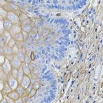 COL1A1 Antibody in Immunohistochemistry (Paraffin) (IHC (P))