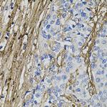 COL1A1 Antibody in Immunohistochemistry (Paraffin) (IHC (P))