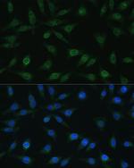 NUP98 Antibody in Immunocytochemistry (ICC/IF)