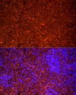 TLR7 Antibody in Immunocytochemistry (ICC/IF)