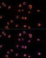 TLR7 Antibody in Immunocytochemistry (ICC/IF)