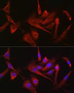 HK1 Antibody in Immunocytochemistry (ICC/IF)