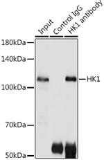 HK1 Antibody in Immunoprecipitation (IP)